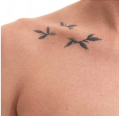 voor een pico laser verwijdering tattoo schouder